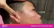 Vụ giáo viên Ấn Độ tát học sinh: Bé trai thủng màng nhĩ, gia đình đưa vào TP.HCM chữa trị