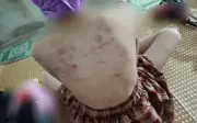 Vụ nữ sinh lớp 4 ở Cao Bằng bị đánh: Mẹ người dân tộc Nùng học hết lớp 7 mong con được bảo vệ
