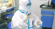 Virus Ebola nguy hiểm thế nào? Triệu chứng và đường lây truyền