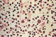 Việt Nam tăng cường kiểm dịch biên giới phòng virus Hanta