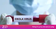 WHO ban bố tình trạng khẩn cấp dịch Ebola, Bộ Y tế khuyến cáo người dân