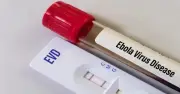 WHO báo động khẩn cấp dịch Ebola, Bộ Y tế Việt Nam ra khuyến cáo