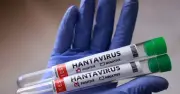 WHO xác nhận 6 ca nhiễm virus hanta trên du thuyền, 3 người tử vong