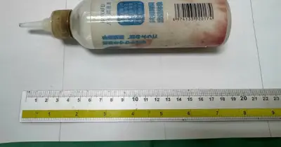 Bệnh nhân tự đưa chai nhựa dài 20 cm vào hậu môn, phải phẫu thuật cấp cứu