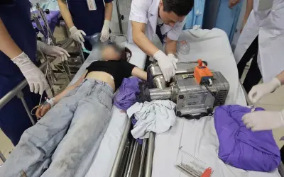 Cô gái 19 tuổi nguy cơ mất bàn tay vĩnh viễn vì sơ suất khi dùng máy xay