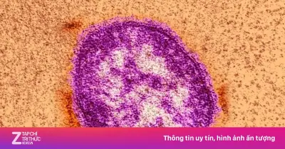 Ca bệnh sởi tại California gây lo ngại lây lan qua sân bay và siêu thị