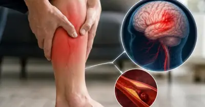 Chuyên gia cảnh báo: 5 dấu hiệu ở bắp chân báo hiệu đột quỵ