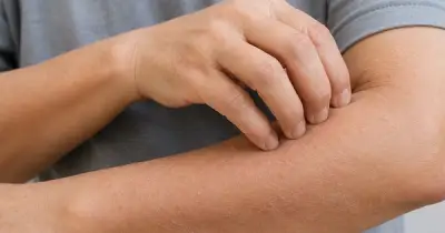 Dấu hiệu trên da cảnh báo bệnh thận bạn không nên bỏ qua