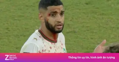 Hai cầu thủ đổ máu trong trận cầu thót tim Hà Lan - Morocco