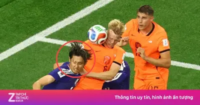 Hiroki Ito và căn bệnh bạch biến giống Michael Jackson tại World Cup 2026