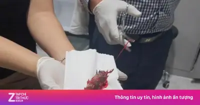 Hy hữu: Người đàn ông Cà Mau bị cá rô chui vào họng khi ngậm cá sống