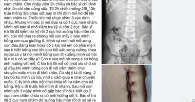 Nghệ An yêu cầu báo cáo vụ bé nuốt nam châm, mổ lấy 1 viên