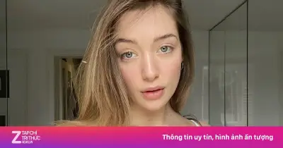 Người mẫu 'đẹp nhất thế giới' đối mặt miệt thị ngoại hình