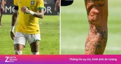Ảnh chân trái biến dạng của Neymar hút hơn 7 triệu lượt xem