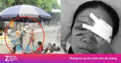 Nạn nhân bị xịt nước cao áp vào mặt vẫn chưa mở được mắt