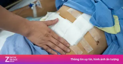 Ung thư gan trẻ hóa: Bác sĩ cảnh báo nguy cơ ít người để ý