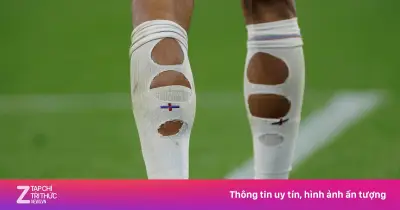 Vì sao cầu thủ World Cup cắt tất thủng lỗ chỗ?