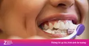 4 sai lầm khi đánh răng khiến hơi thở nặng mùi, răng yếu đi