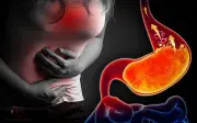 5 loại trái cây ít chua tốt cho người trào ngược dạ dày