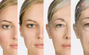 7 dấu hiệu lão hóa nhanh nhiều người tưởng bình thường