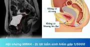 Bé gái 14 tuổi chưa có kinh nguyệt, phát hiện không có tử cung vì hội chứng MRKH hiếm gặp