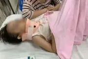 Bé gái 4 tuổi bị xô ngã từ cầu trượt, vỡ xương trán phải nhập viện cấp cứu