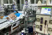 Bé trai sốc tim nguy kịch sau sốt nhẹ do siêu vi Rhinovirus