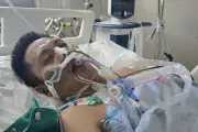 Bác sĩ Bạch Mai kêu gọi cứu bố 2 con, viện phí 50 triệu đồng/ngày