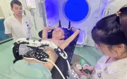 Bệnh nhân ung thư Trúc Trang di căn phổi được xạ trị một lần duy nhất: Bước tiến trong điều trị cá thể hóa