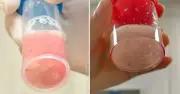 Cô bé 12 tuổi phổi trắng xóa sau 1 ngày sốt, bác sĩ cảnh báo nguy hiểm
