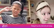 Cô gái 18 tuổi từng 'dao kéo' hơn 100 lần giờ ra sao?