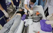 Cô gái 19 tuổi nguy cơ mất bàn tay vĩnh viễn vì sơ suất khi dùng máy xay