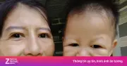 Cô gái mang gương mặt bà cụ vì lão hóa sớm, giờ ra sao?