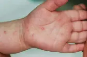 Cà Mau: Bé trai 3 tuổi tử vong vì tay chân miệng, hơn 1.400 ca từ đầu năm