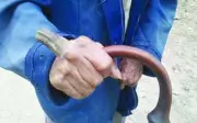 Cụ ông Trung Quốc 'mọc sừng' dài 10 cm trên tay suốt 10 năm