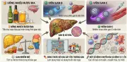 Chăm sóc người bệnh xơ gan tại nhà: 5 nguyên tắc vàng cần nhớ