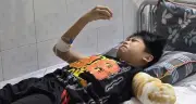 Cậu bé 11 tuổi bị điện giật, mẹ ơi tay con đau rồi