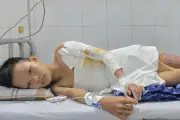 Cậu bé lớp 8 bị bỏng điện òa khóc xin cứu đôi chân