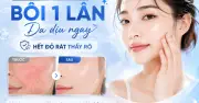 Da nhạy cảm không phải loại da, mà là dấu hiệu hàng rào bảo vệ bị tổn thương