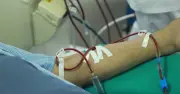 Dấu hiệu cảnh báo suy thận dễ bỏ qua, bác sĩ khuyên đi khám ngay
