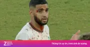 Hai cầu thủ đổ máu trong trận cầu thót tim Hà Lan - Morocco