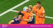 Hiroki Ito và căn bệnh bạch biến giống Michael Jackson tại World Cup 2026