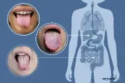 Lưỡi tiết lộ gì về sức khỏe? Nghiên cứu mới chỉ ra độ chính xác 95%