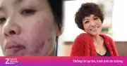 Nữ diễn viên Bảo Bội Như bị tát bầm mặt vì cảnh quay thật