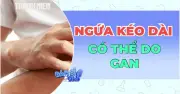 Ngứa da kéo dài có thể là dấu hiệu cảnh báo bệnh gan