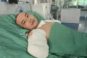 Người bố 4 con nguy kịch vì bỏng điện bật khóc cầu cứu