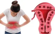 Người phụ nữ 45 tuổi suýt gặp biến chứng nặng vì mắc đái tháo đường và bệnh phụ khoa kéo dài