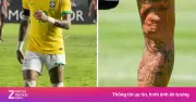 Ảnh chân trái biến dạng của Neymar hút hơn 7 triệu lượt xem