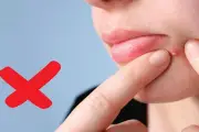 Nhiều chị em ở TPHCM bị biến dạng mặt vì tự nặn mụn