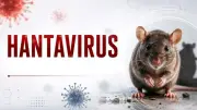 Nhận biết sớm bệnh do virus Hanta để tránh biến chứng nặng